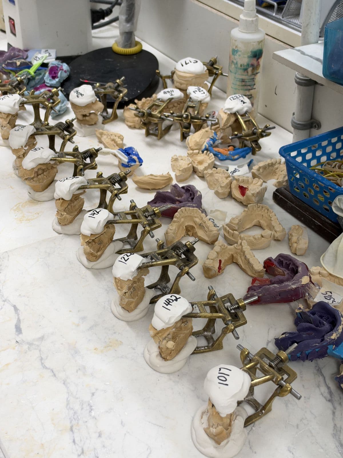 Rows of mounted models on articulators, each labeled with its case number